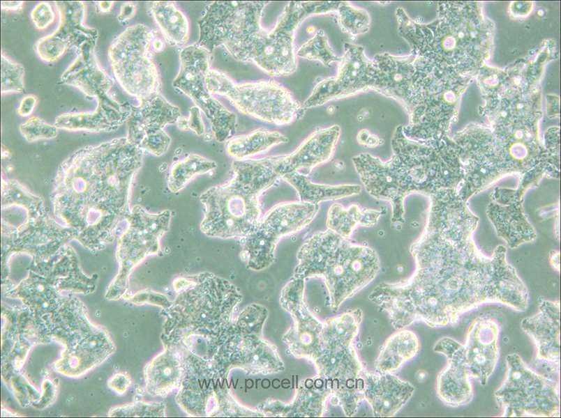 SW948 (人結(jié)腸腺癌細(xì)胞) (STR鑒定正確)