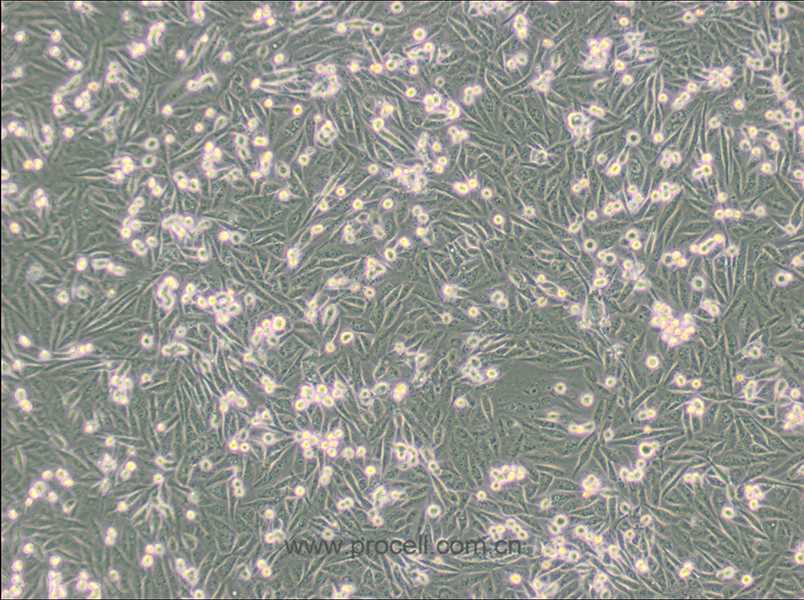 MDA-MB-231-GFP (人乳腺癌細(xì)胞(綠色熒光蛋白標(biāo)記) (STR鑒定正確)