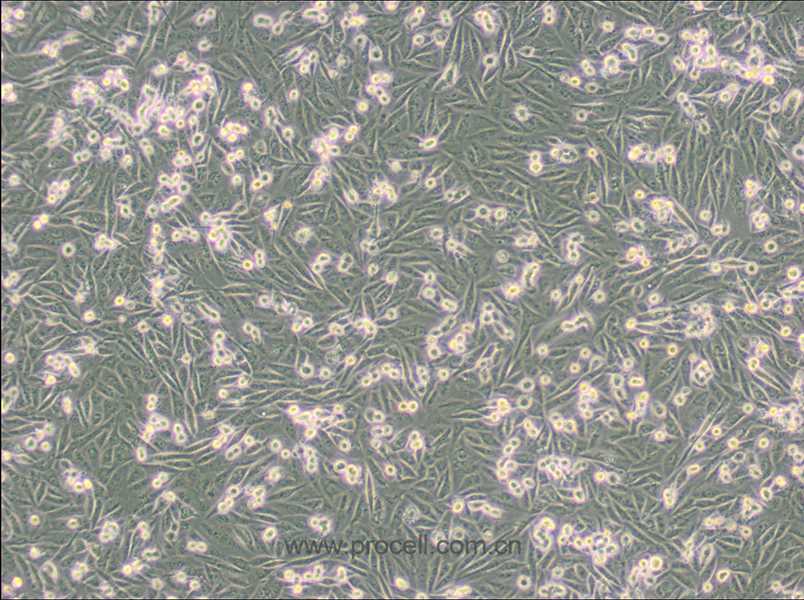 MDA-MB-231-GFP (人乳腺癌細(xì)胞(綠色熒光蛋白標(biāo)記) (STR鑒定正確)