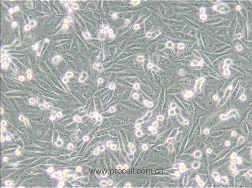 MDA-MB-231-GFP (人乳腺癌細(xì)胞(綠色熒光蛋白標(biāo)記) (STR鑒定正確)