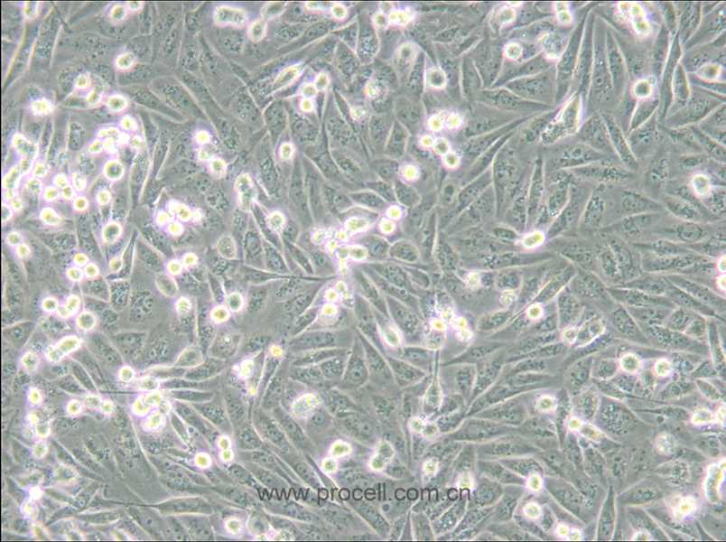 MDA-MB-231-GFP (人乳腺癌細(xì)胞(綠色熒光蛋白標(biāo)記) (STR鑒定正確)