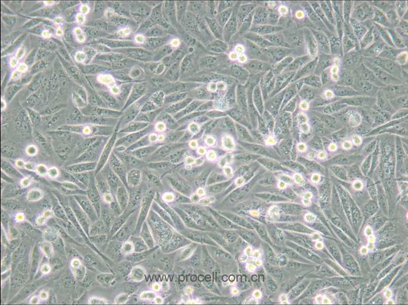 MDA-MB-231-GFP (人乳腺癌細(xì)胞(綠色熒光蛋白標(biāo)記) (STR鑒定正確)
