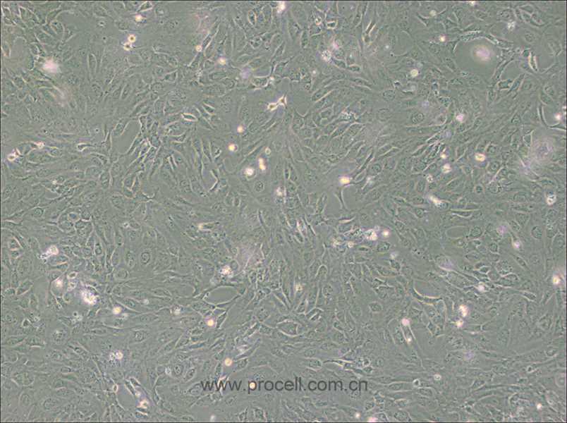 PUMC-HUVEC-T1 (SV40T轉(zhuǎn)化人臍靜脈內(nèi)皮細(xì)胞) (STR鑒定正確)