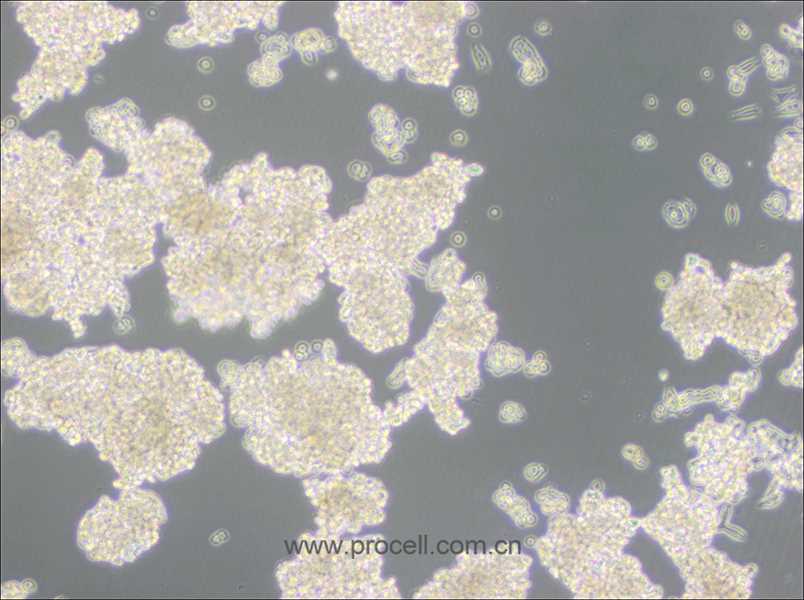 D341Med(人髓母細(xì)胞瘤細(xì)胞) (STR鑒定正確)