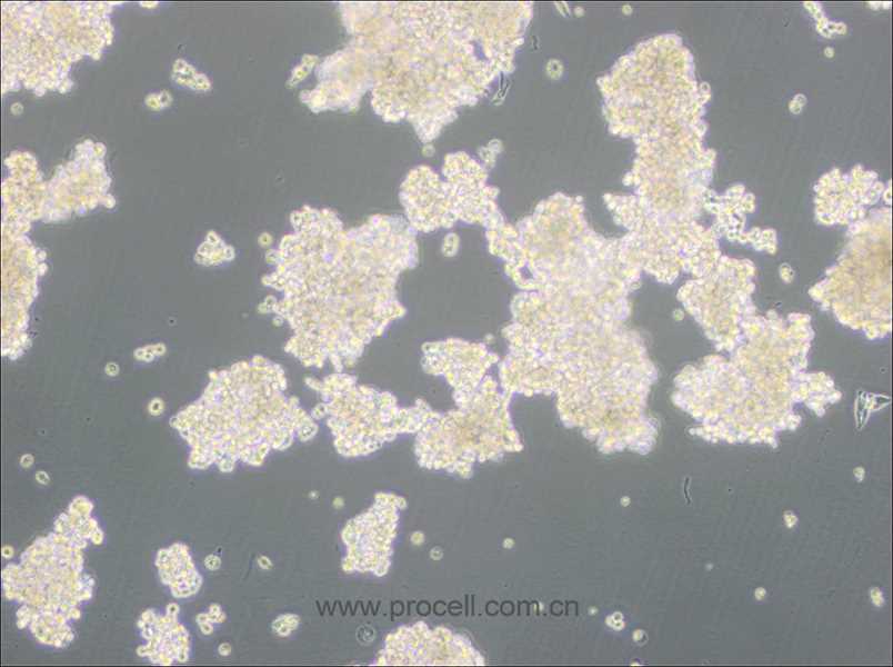 D341Med(人髓母細(xì)胞瘤細(xì)胞) (STR鑒定正確)