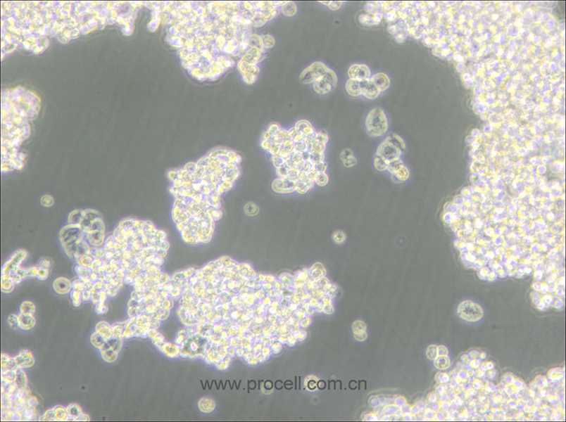 D341Med(人髓母細(xì)胞瘤細(xì)胞) (STR鑒定正確)