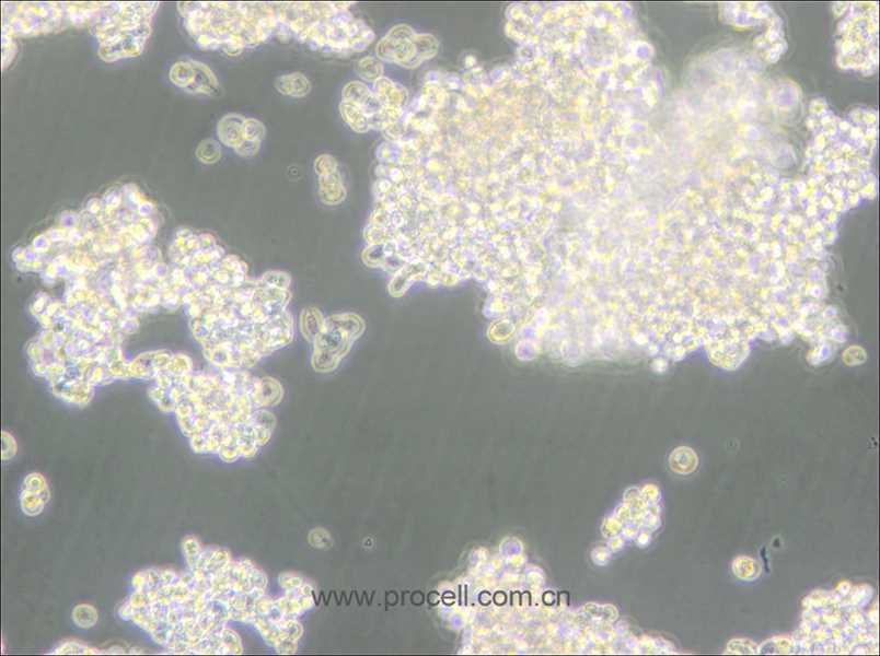 D341Med(人髓母細(xì)胞瘤細(xì)胞) (STR鑒定正確)