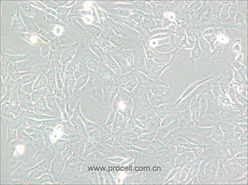 SW872 (人脂肪肉瘤細胞) (STR鑒定正確)