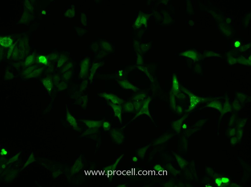 U-2 OS-GFP（人骨肉瘤細(xì)胞（綠色熒光蛋白標(biāo)記））（STR鑒定正確）