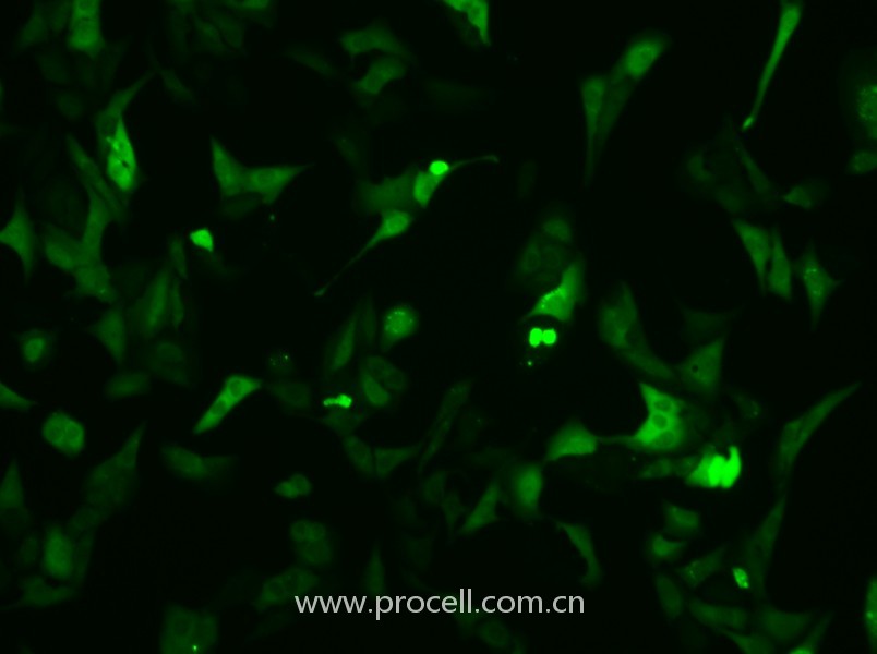 U-2 OS-GFP（人骨肉瘤細胞（綠色熒光蛋白標記））（STR鑒定正確）