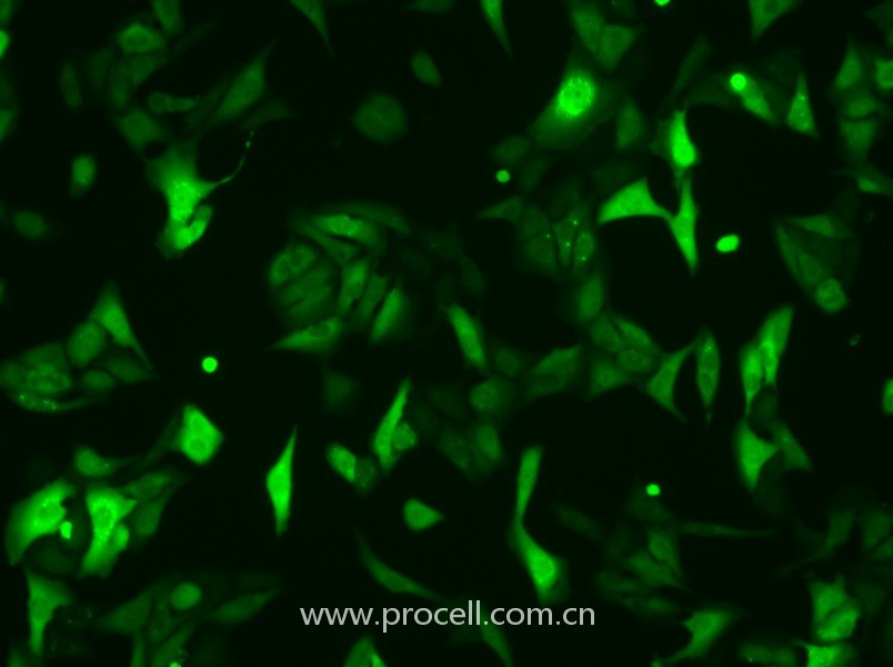 U-2 OS-GFP（人骨肉瘤細胞（綠色熒光蛋白標記））（STR鑒定正確）