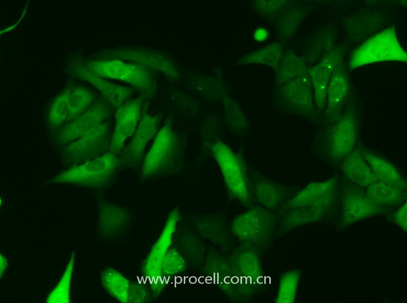 U-2 OS-GFP（人骨肉瘤細胞（綠色熒光蛋白標記））（STR鑒定正確）