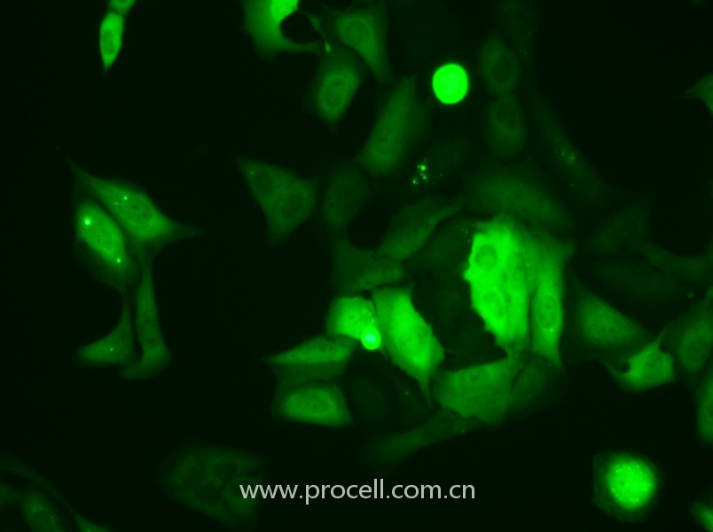 U-2 OS-GFP（人骨肉瘤細胞（綠色熒光蛋白標記））（STR鑒定正確）