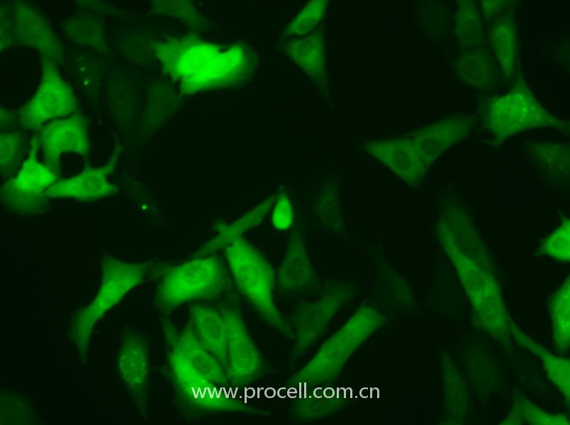 U-2 OS-GFP（人骨肉瘤細胞（綠色熒光蛋白標記））（STR鑒定正確）