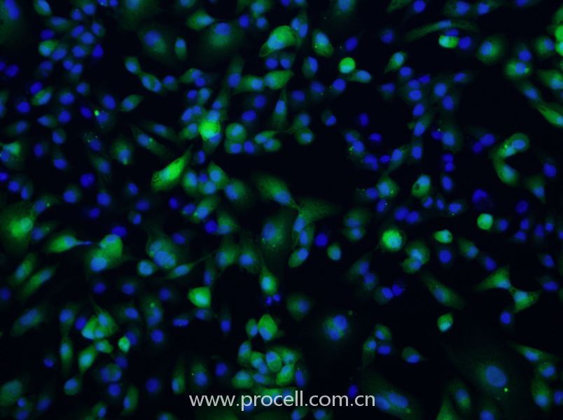 ACHN-GFP (人腎細(xì)胞腺癌細(xì)胞(綠色熒光標(biāo)記)) (STR鑒定正確)