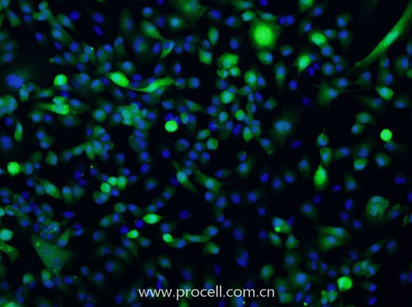 ACHN-GFP (人腎細(xì)胞腺癌細(xì)胞(綠色熒光標(biāo)記)) (STR鑒定正確)