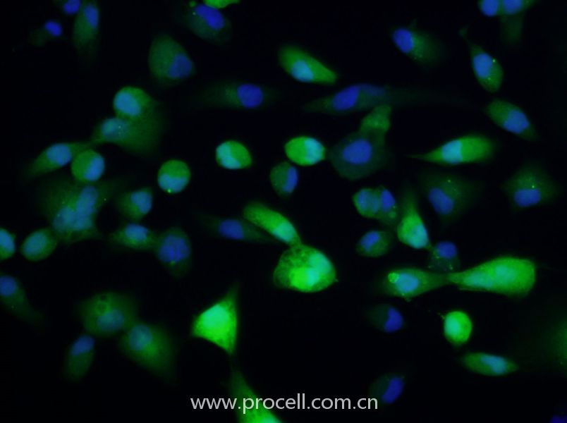 ACHN-GFP (人腎細(xì)胞腺癌細(xì)胞(綠色熒光標(biāo)記)) (STR鑒定正確)