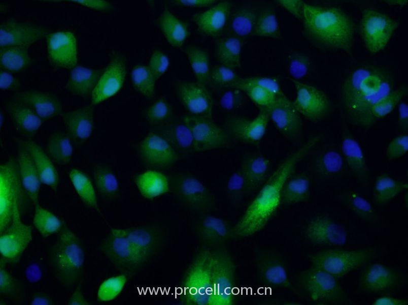 ACHN-GFP (人腎細(xì)胞腺癌細(xì)胞(綠色熒光標(biāo)記)) (STR鑒定正確)
