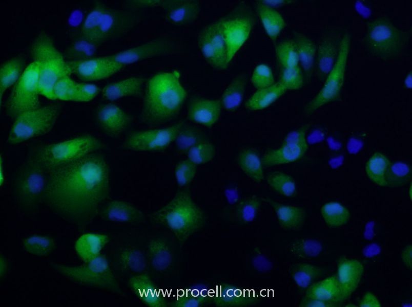 ACHN-GFP (人腎細(xì)胞腺癌細(xì)胞(綠色熒光標(biāo)記)) (STR鑒定正確)