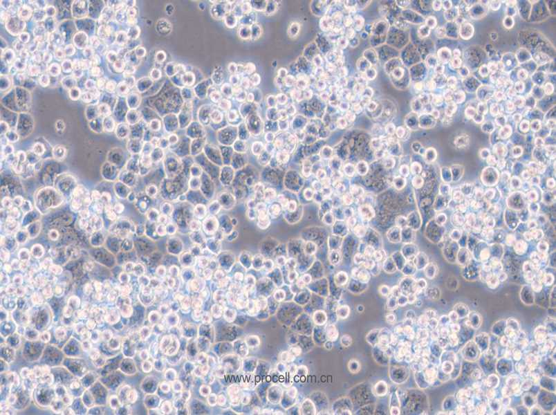 MDA-kb2 (人乳腺癌細(xì)胞)  (STR鑒定正確)