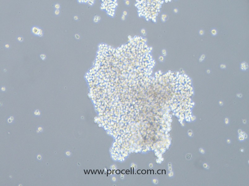 SHP-77（人小細胞肺癌細胞）（STR鑒定正確）