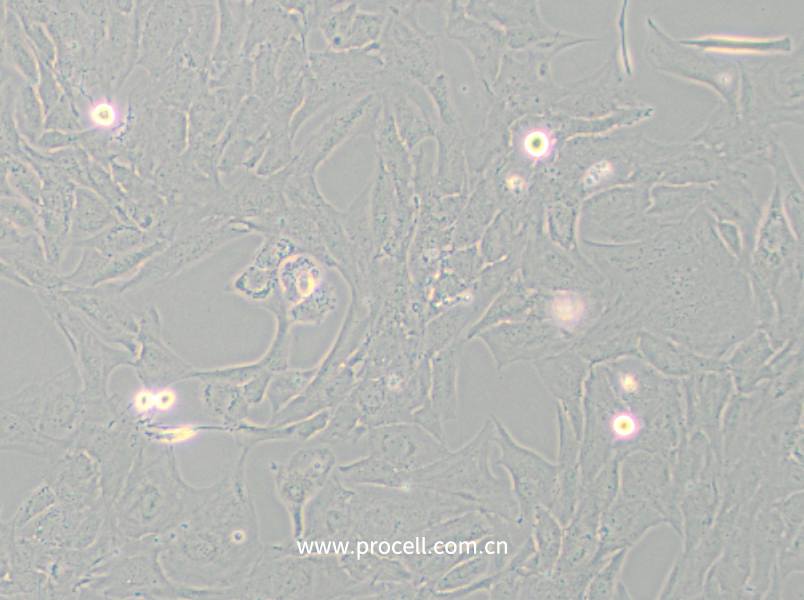 NCI-H196 (人小細(xì)胞肺癌細(xì)胞) (STR鑒定正確)