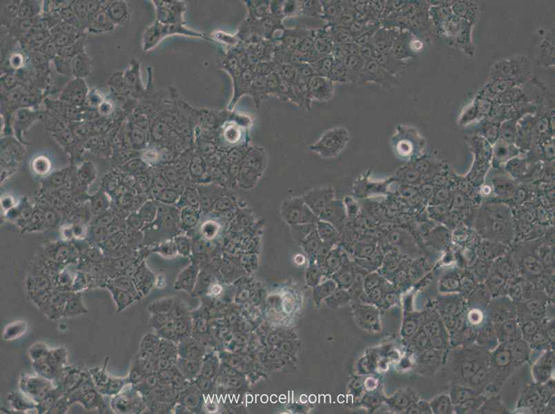 NCI-H1573 (人肺癌腺癌細(xì)胞) (STR鑒定正確)