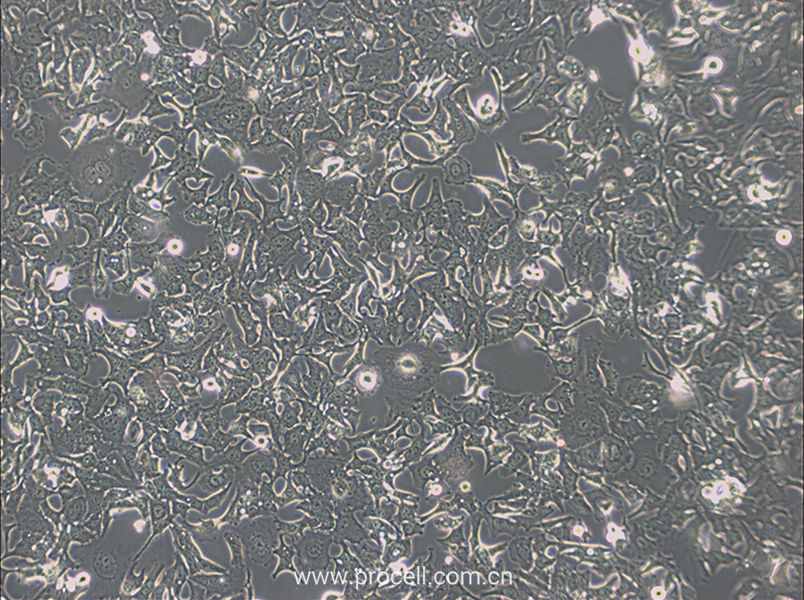 HCC1954 (人乳腺導管癌細胞) (STR鑒定正確)
