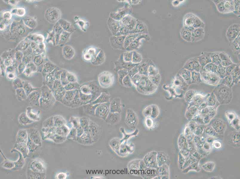 HCC1428 (人乳腺腺癌細胞) (STR鑒定正確)