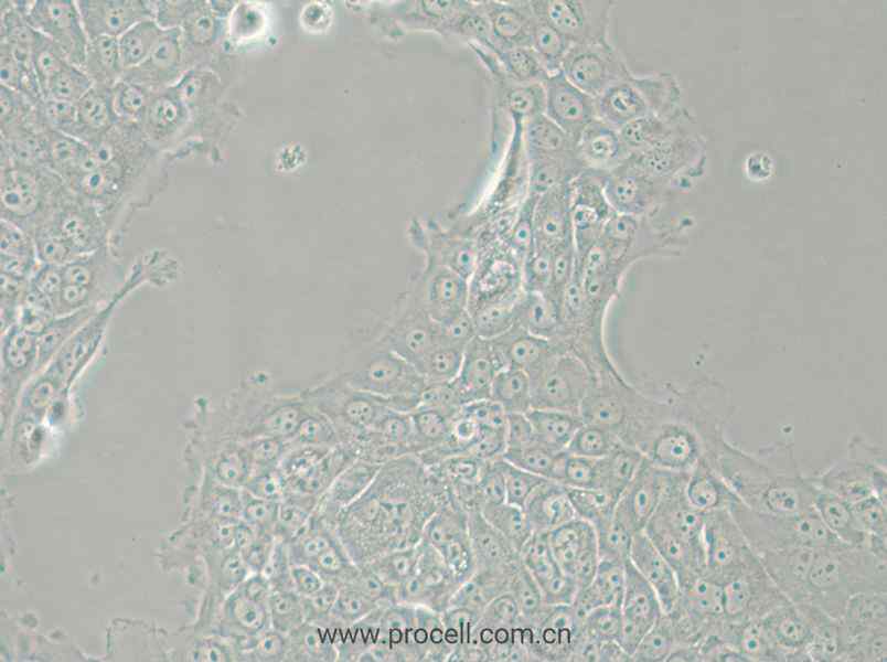 MCF-12A (人乳腺上皮細胞) (STR鑒定正確)