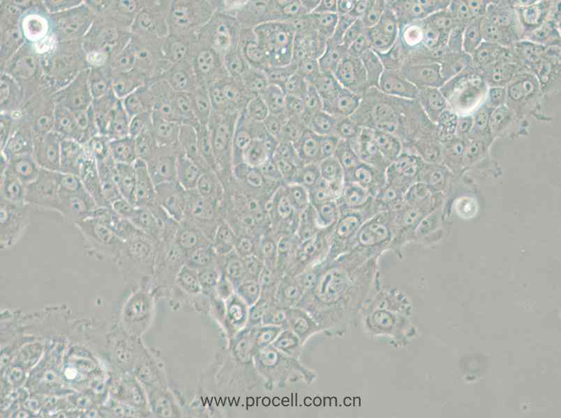 MCF-12A (人乳腺上皮細胞) (STR鑒定正確)