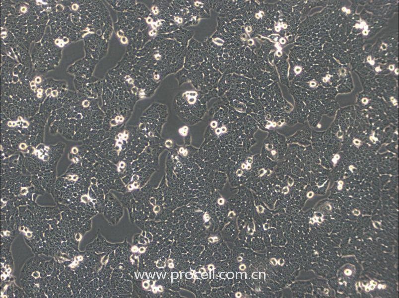 WSU-HN30 (人口腔鱗狀細(xì)胞) (STR鑒定正確)
