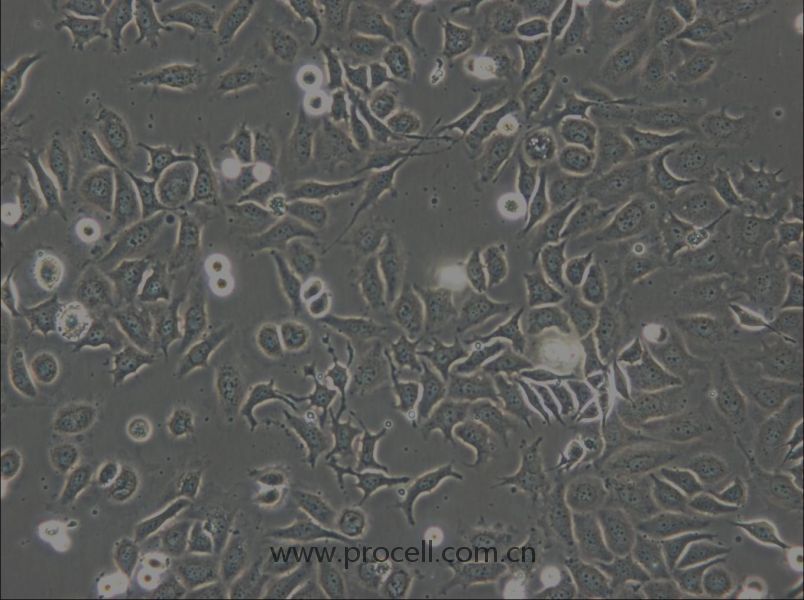 NP69SV40T (人鼻咽上皮細(xì)胞) (STR鑒定正確)
