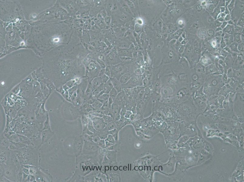 SU.86.86 (人胰腺導管癌細胞) (STR鑒定正確)