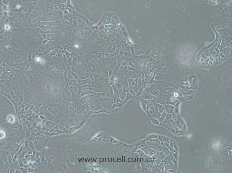 SU.86.86 (人胰腺導管癌細胞) (STR鑒定正確)