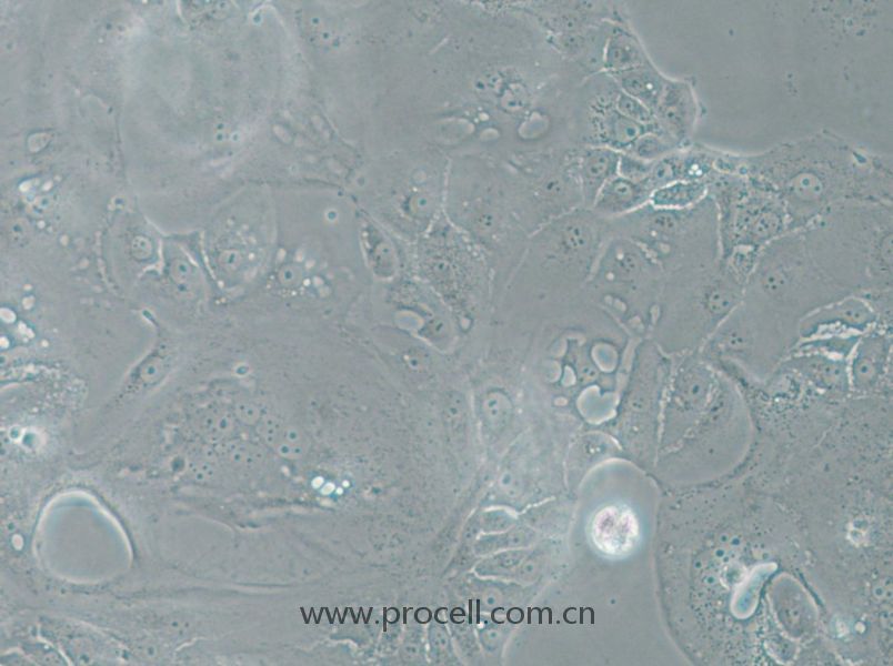 SU.86.86 (人胰腺導管癌細胞) (STR鑒定正確)