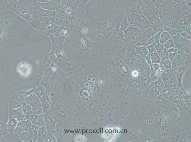 SU.86.86 (人胰腺導管癌細胞) (STR鑒定正確)