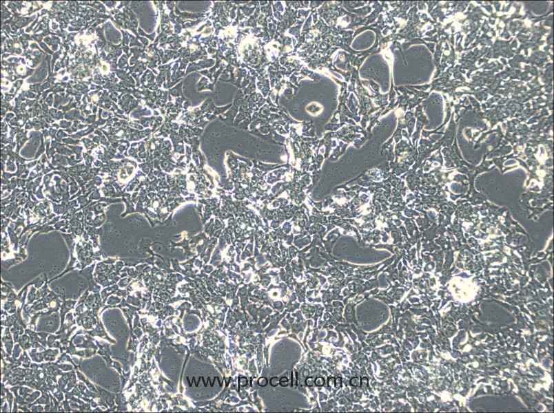 HCC70 (人乳腺導(dǎo)管癌細(xì)胞) (STR鑒定正確)