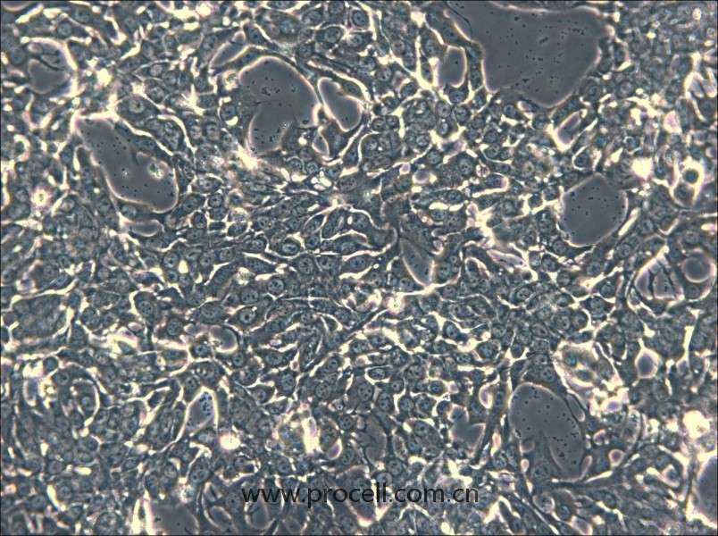 HCC70 (人乳腺導(dǎo)管癌細(xì)胞) (STR鑒定正確)