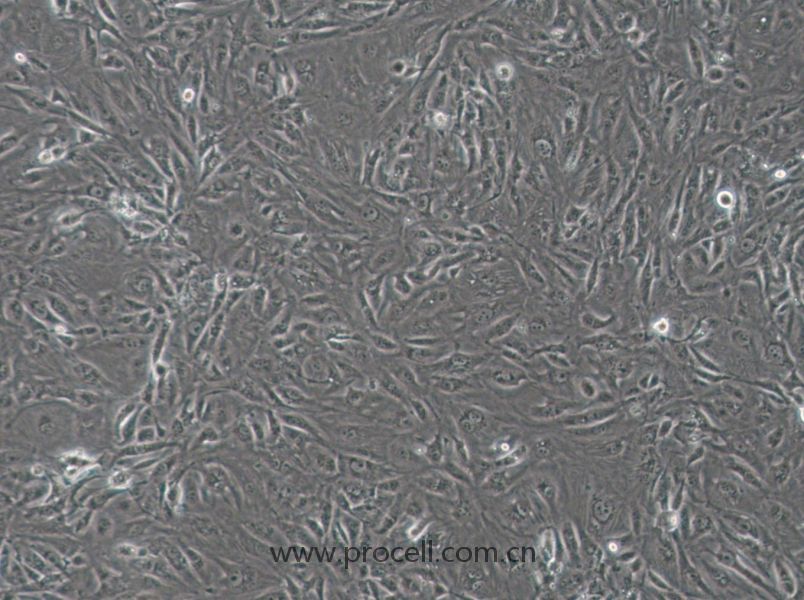 SW1710 (人膀胱癌細(xì)胞) (STR鑒定正確)