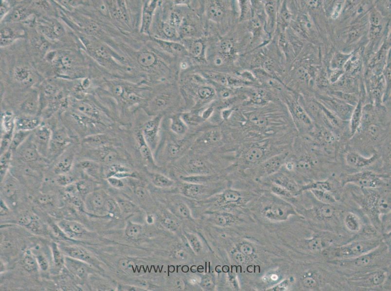 SW1710 (人膀胱癌細(xì)胞) (STR鑒定正確)
