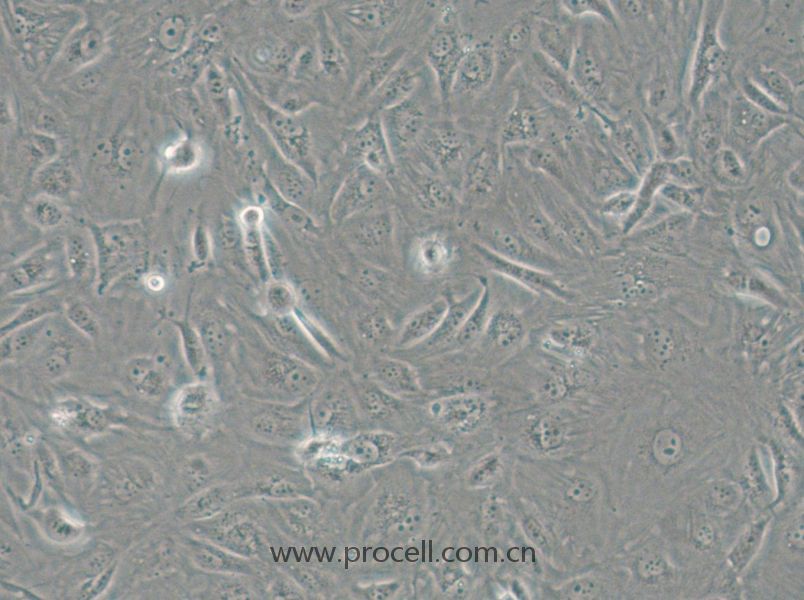 SW1710 (人膀胱癌細(xì)胞) (STR鑒定正確)