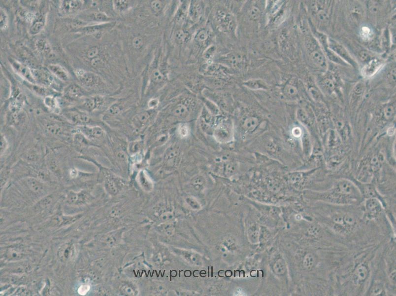 SW1710 (人膀胱癌細(xì)胞) (STR鑒定正確)