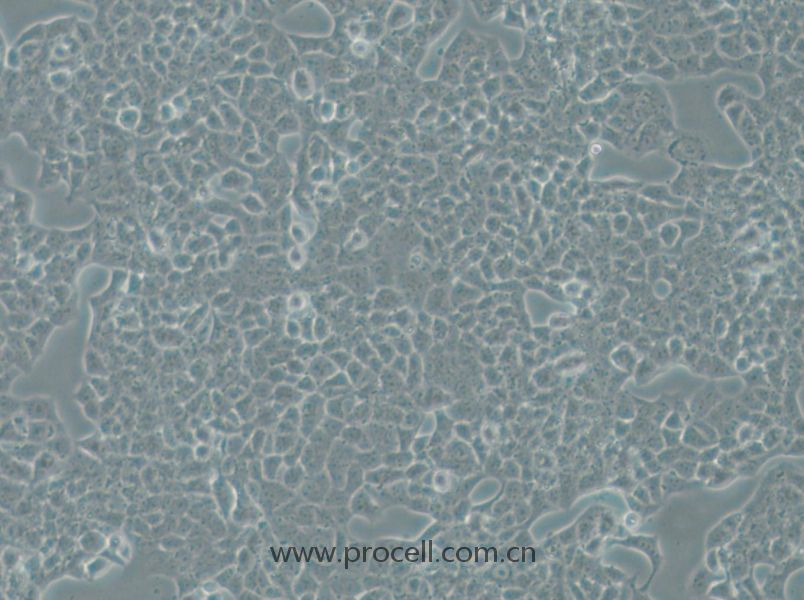RPMI-2650 (人鼻腔上皮細胞) (STR鑒定正確)