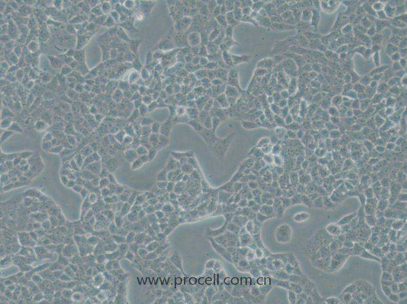 RPMI-2650 (人鼻腔上皮細胞) (STR鑒定正確)