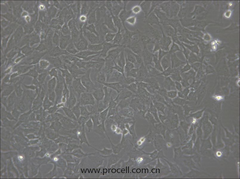 hCMEC/D3 (人腦微血管內(nèi)皮細胞) (STR鑒定正確)