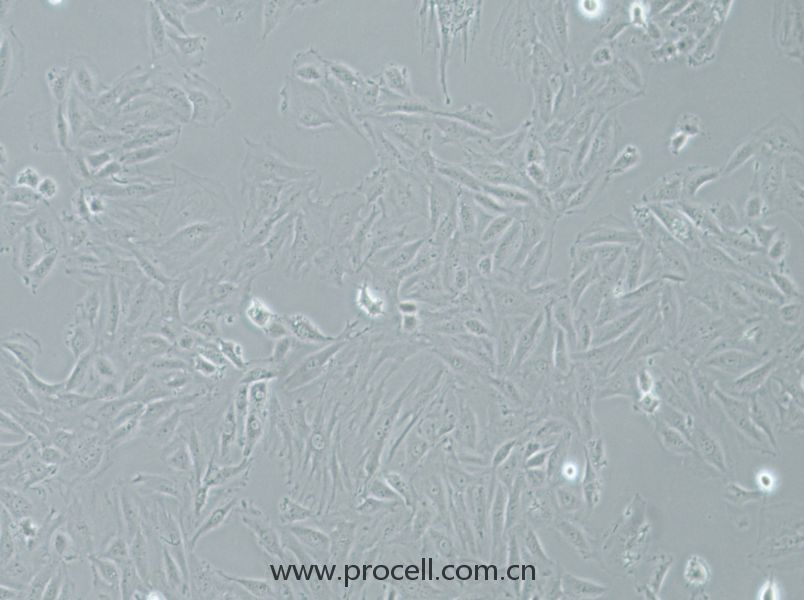 NRK-49F (大鼠正常腎成纖維細(xì)胞) (種屬鑒定正確)