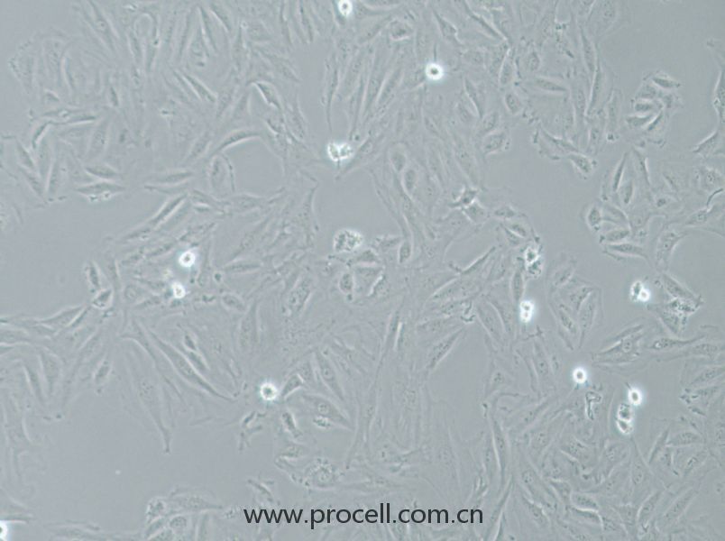 NRK-49F (大鼠正常腎成纖維細(xì)胞) (種屬鑒定正確)