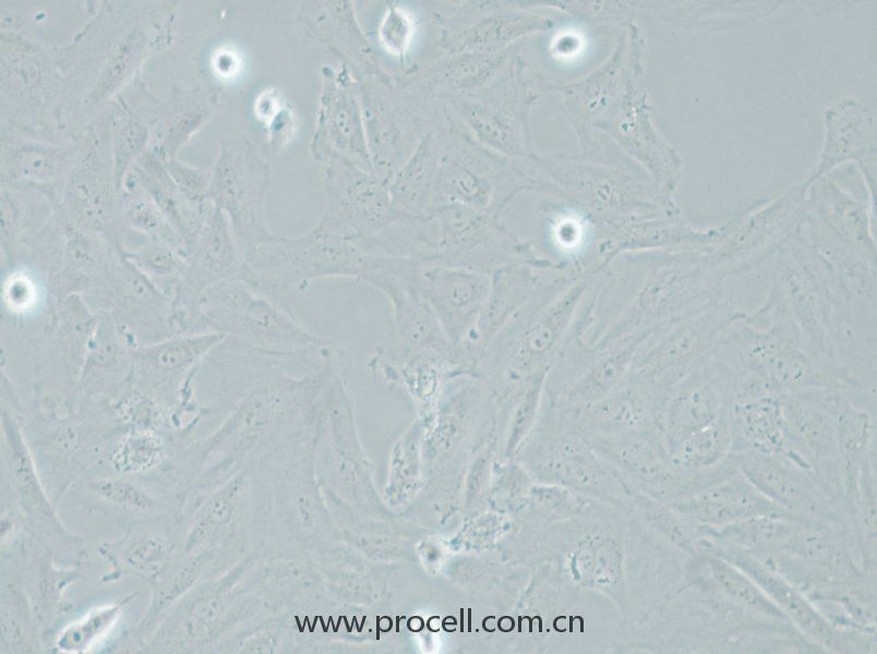 NRK-49F (大鼠正常腎成纖維細(xì)胞) (種屬鑒定正確)