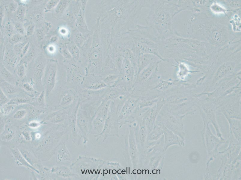 NRK-49F (大鼠正常腎成纖維細(xì)胞) (種屬鑒定正確)